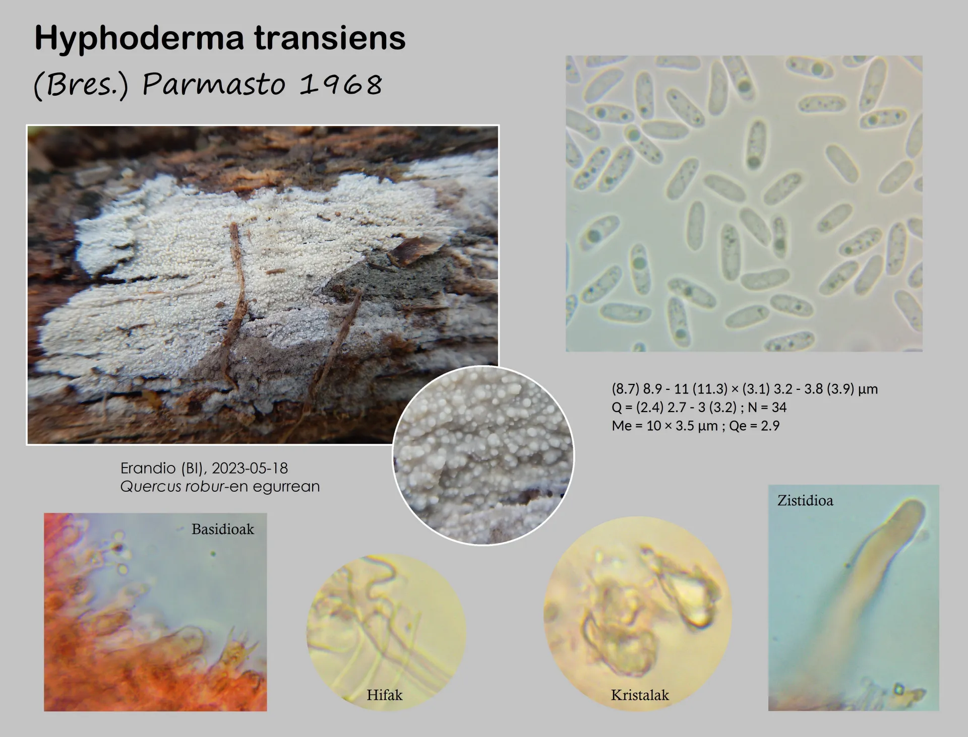 Microscopía de Hyphoderma transiens